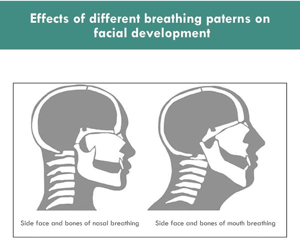 How nasal and mouth breathing shape the bones of the face